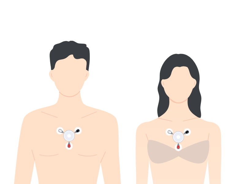Tư vấn và thiết lập chương trình Holter ECG